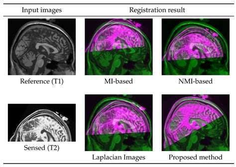 Multi-Modal Medical Image Registration with Full or Partial Data: A ...