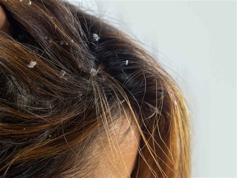 How Does Hard Water Impact Your Hair – WaterScience