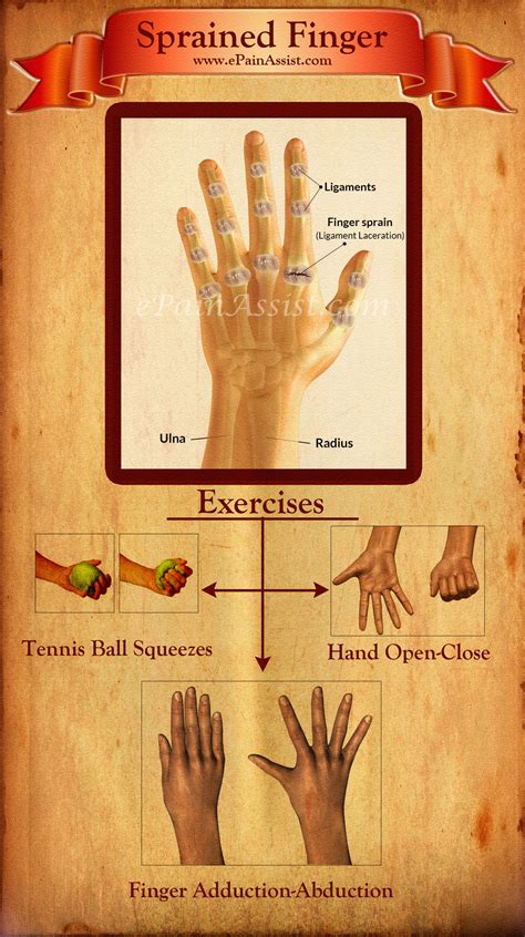 Sprained Finger or Finger Sprain|Types|Causes|Signs|Symptoms|Treatment|Exercises