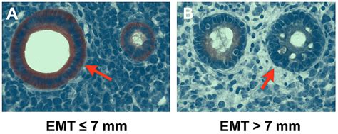 NF-κB as an Inflammatory Biomarker in Thin Endometrium: Predictive ...