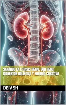 Sanando la Litiasis Renal con Reiki: Bienestar Holístico y Energía ...