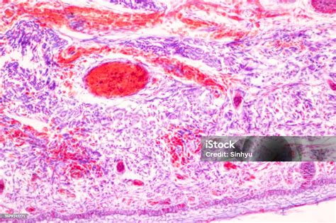 Image result for Finger Under Microscope