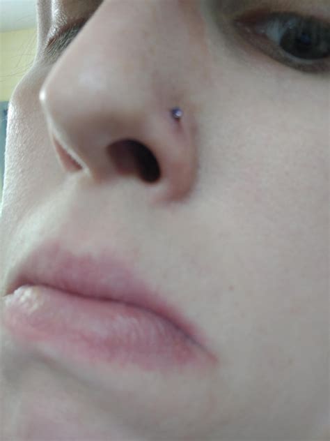 Nose Piercing Infection : r/PiercingAdvice