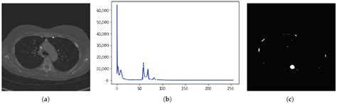 Optimal Thresholding for Multi-Window Computed Tomography (CT) to ...