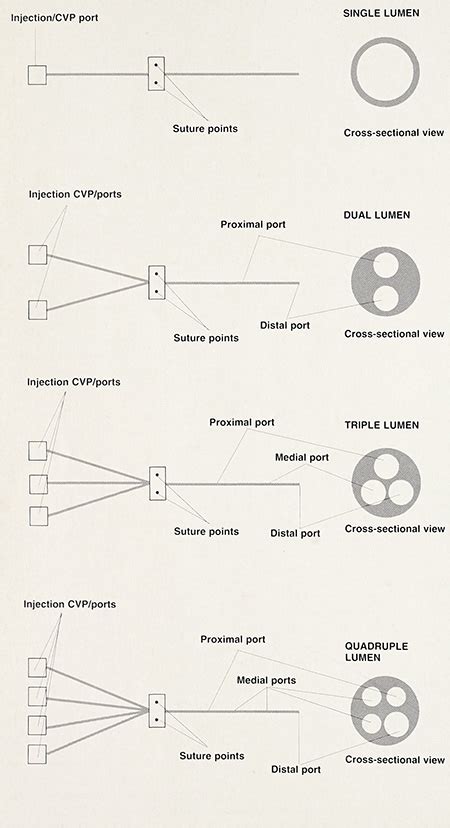 Image result for CVC Line Distal Port
