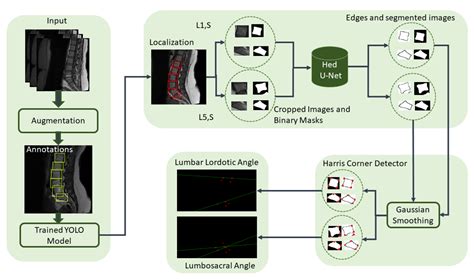 Localization and Edge-Based Segmentation of Lumbar Spine Vertebrae to ...