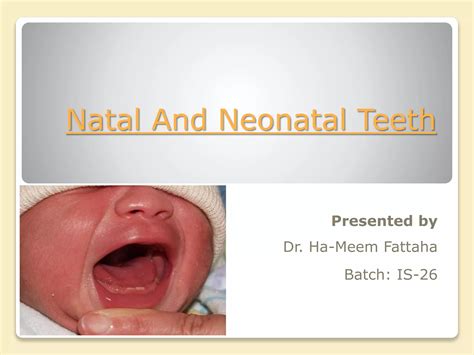 Natal and neonatal teeth | PPTX