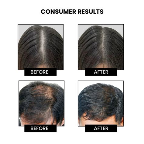 Rosemary Shampoo for Hair Fall Control & Hair Growth | ThriveCo