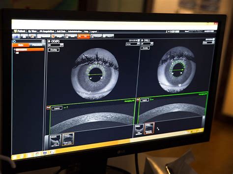 Image result for Optical Coherence Tomography Tutorial