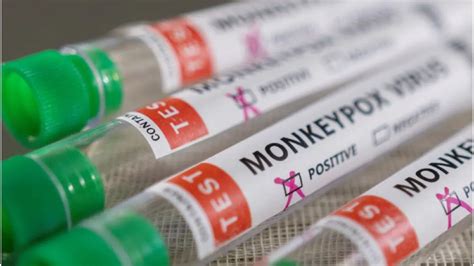 Monkeypox cases in Britain exceed 500