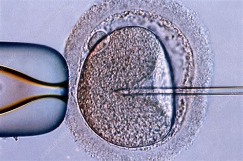 Image result for In Vitro Reproduction