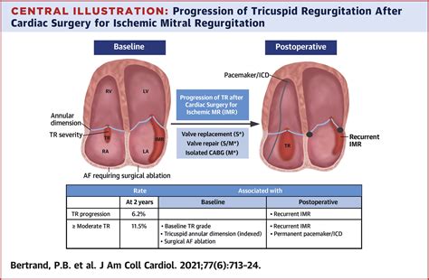 Progression of Tricuspid Regurgitation After Surgery for Ischemic ...