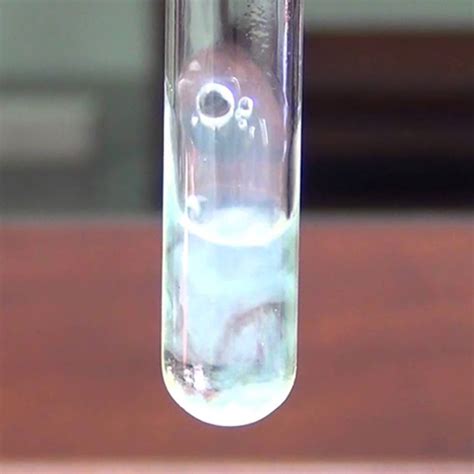 What Does The 24-Hour Urine Albumin Test Mean? Its Importance and ...