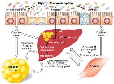 Fructose and NAFLD: The Multifaceted Aspects of Fructose Metabolism