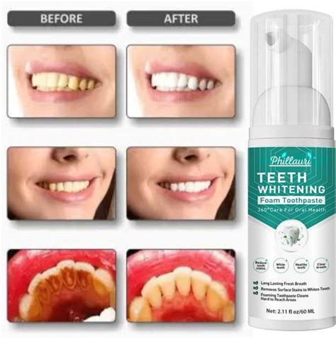 Teeth Whitening Products Online in India at Best Prices | Flipkart.com