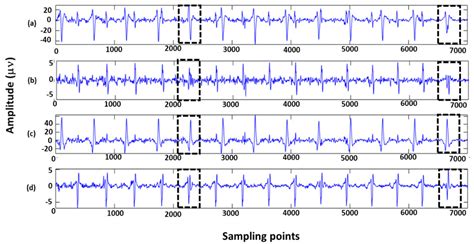 Fetal Electrocardiogram Signal Extraction Based on Fast Independent ...