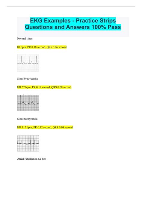 Image result for Synchronized Cardioversion EKG Strips Practice
