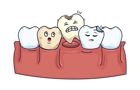 牙齿松动有哪些等级？如何预防牙齿松动？过早拔掉松动的乳牙会有何影响？（牙齿松动系列二） – 纽约 牙科诊所 皇后区 法拉盛 洗牙 人工 植牙 ...
