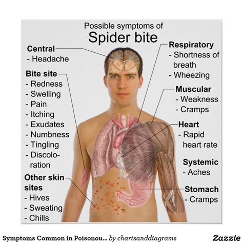 Do Zombie Spiders Bite at Kathaleen Velasquez blog