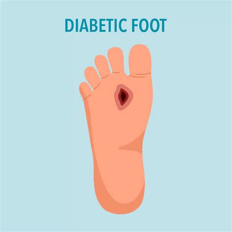 Diabetic Feet: Causes, Symptoms, and Treatment Options | The Bone & Joint Center