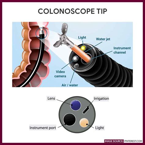 Colonoscopy 的图像结果