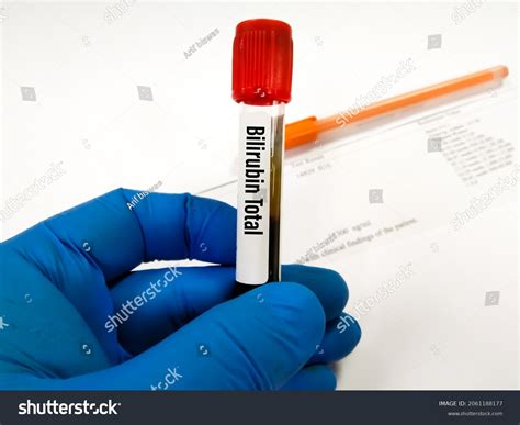 Blood Sample Tube Bilirubin Total Test Stock Photo 2061188177 | Shutterstock