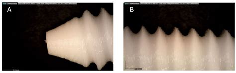 Osteointegration of 3D-Printed PLA Screws: A Head-to-Head Comparison ...