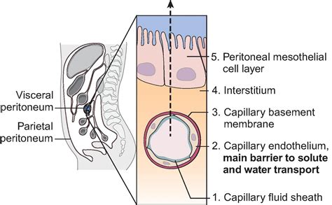 Peritoneal Dialysis - Clinical Tree