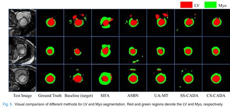 Guest Editors' Introduction: The New Frontier of Human-Level Artificial Intelligence | IEEE Journals