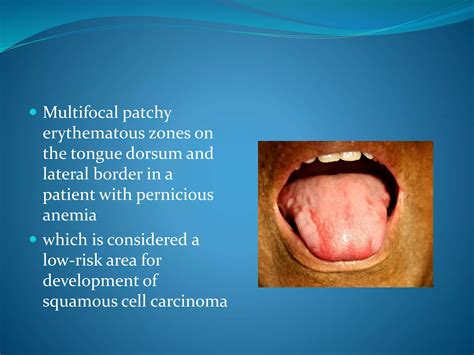 Oral manifestations in systemic diseases | PPTX
