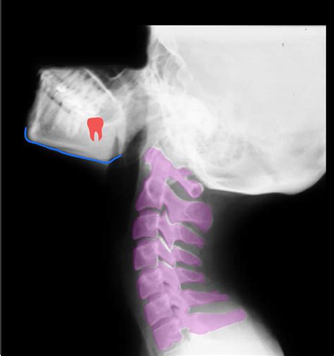 x-ray of neck Diagram | Quizlet