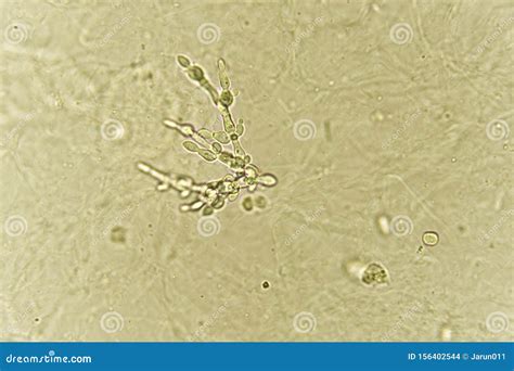 Pseudohyphae and Budding Yeast Cells in Patient Urine Stock Photo ...