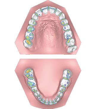 Virgo Solutions - Romexis imaging software