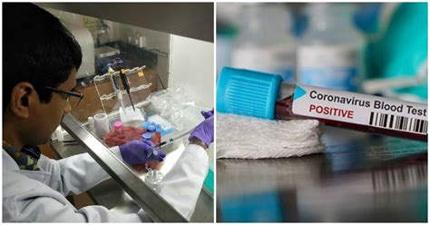 Indian-Origin Scientist Develops Test That Visually Detects Coronavirus ...