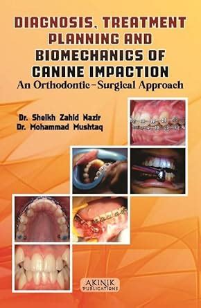 Amazon.in: Buy Diagnosis, Treatment Planning and Biomechanics of Canine ...