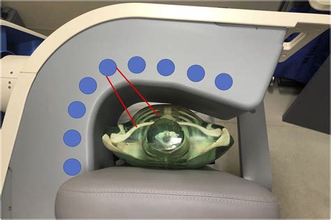 Image result for Labelled SPECT Machine