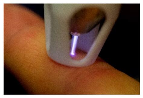 Concept for Improved Handling Ensures Effective Contactless Plasma ...