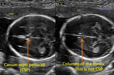 Image result for Biometry Ob