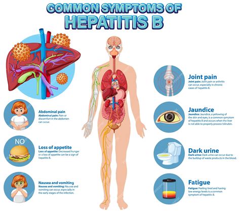 Free Vector | Informative poster of common symptoms Hepatitis B