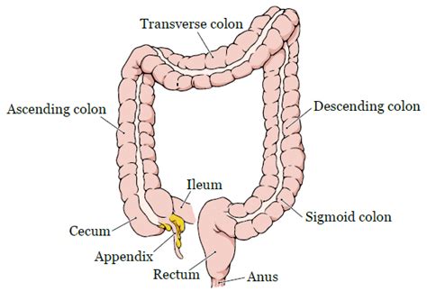 Image result for Open Colon Resection Surgery
