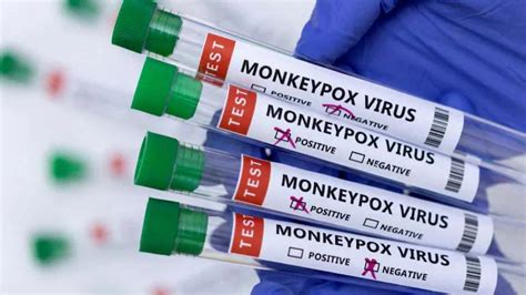 Monkeypox symptoms, causes and precautions: Medical experts answer key ...