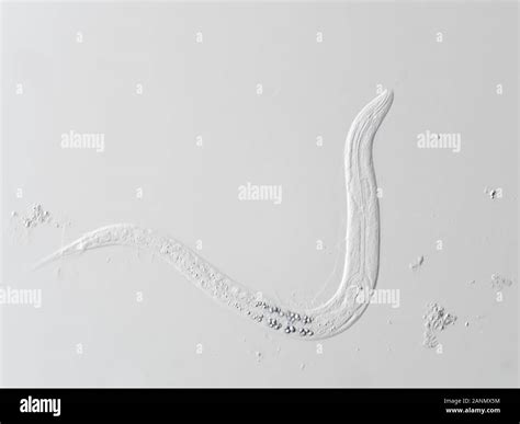 Pinworm Under Microscope
