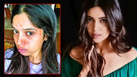 5 Bollywood Actresses With Bad Skin | Truth Beneath Makeup Layers ...