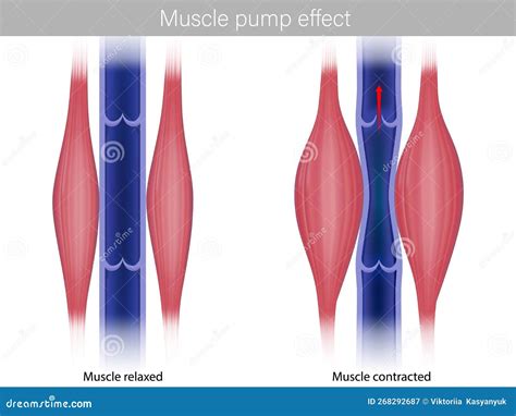 Skeletal Muscle Pump Effect. Illustration of Muscle Pump Effect on ...
