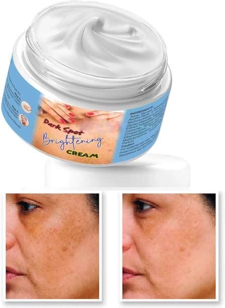 Dark Spot Removal Cream | Dark Spot correction Cream | Flipkart