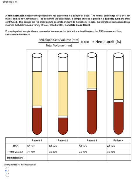 (Solved) - A hematocrit test measures the proportion of red blood cells in a... (1 Answer ...