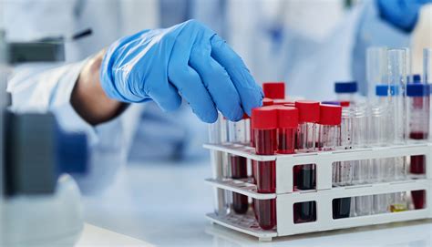 What to know about blood clots: risks and prevention