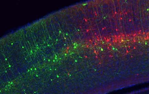 Image result for Brain Cell Types