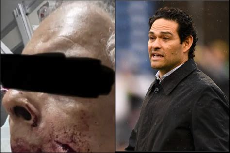 Mark Sanchez Attack Victim Perry Tole Sues Him For Assault Following ...
