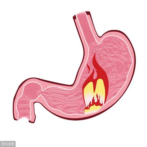 口臭、胃酸、便秘多是胃火惹的禍，教你一個穴位，滅“胃火”(消化不良) - 穴道經絡引導